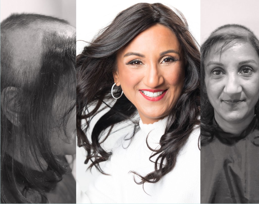 Truly You - Hair loss clinic in Mississauga